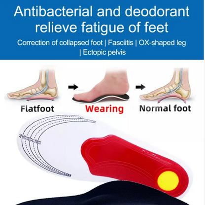 🔥Arch Support Foot Insoles（60% OFF）🚚Cash on Delivery