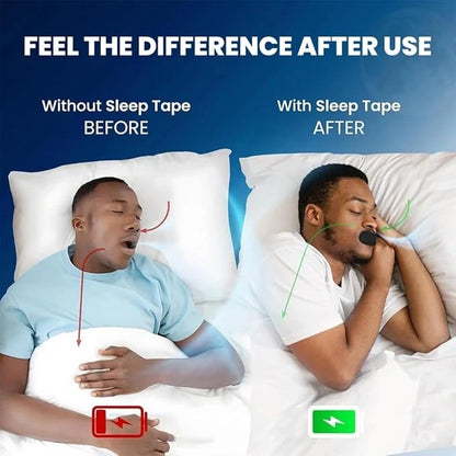 SilentBreathe™ (PACK OF 30!) –  Anti-Snoring Mouth Strips | Improves Breathing & Sleep | Reduce Snoring | Drug-Free & Instant Relief