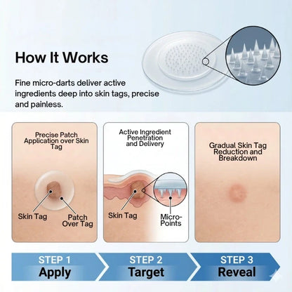 DermaCare™ - Acne/ Tag/ Mole Eraser | Spot Fixers | Clear Invisible Stickers
