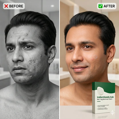 DermaCare™ - Acne/ Tag/ Mole Eraser | Spot Fixers | Clear Invisible Stickers